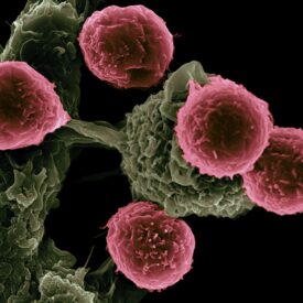 Do Infrared Heaters Cause Cancer? Debunking the Myths with Science